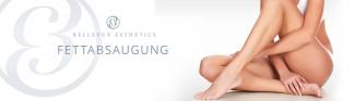 Kosten/Preise für eine Liposuktion/Fettabsaugung in der Schweiz